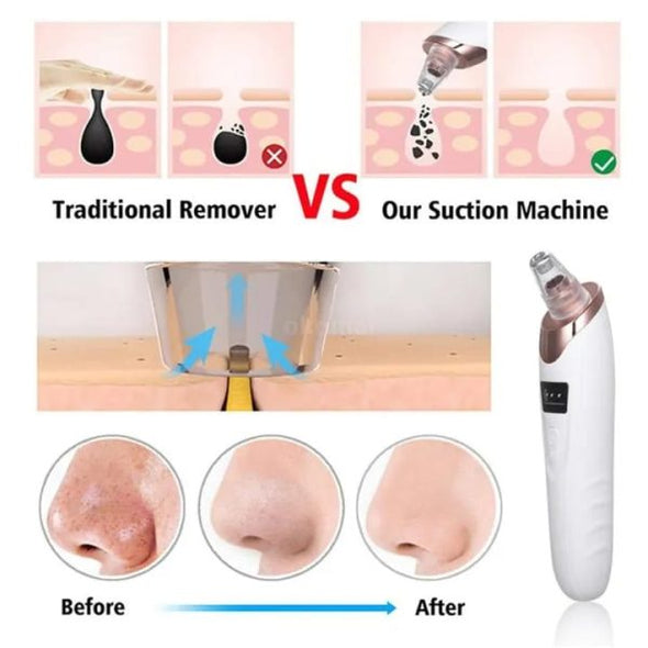 Electric Deep Cleansing Tool For Nose & Face